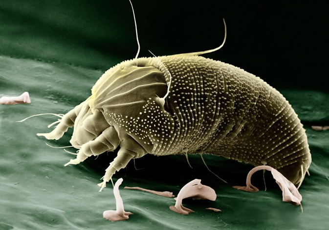Close up of microscopic allergen cleaning or dust concept